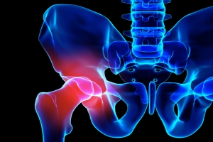 Robotic Hip Replacement Recovery Time and Post-Surgery Care